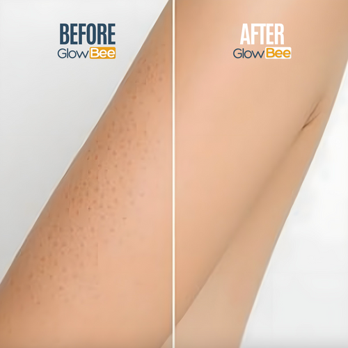 GlowBee®